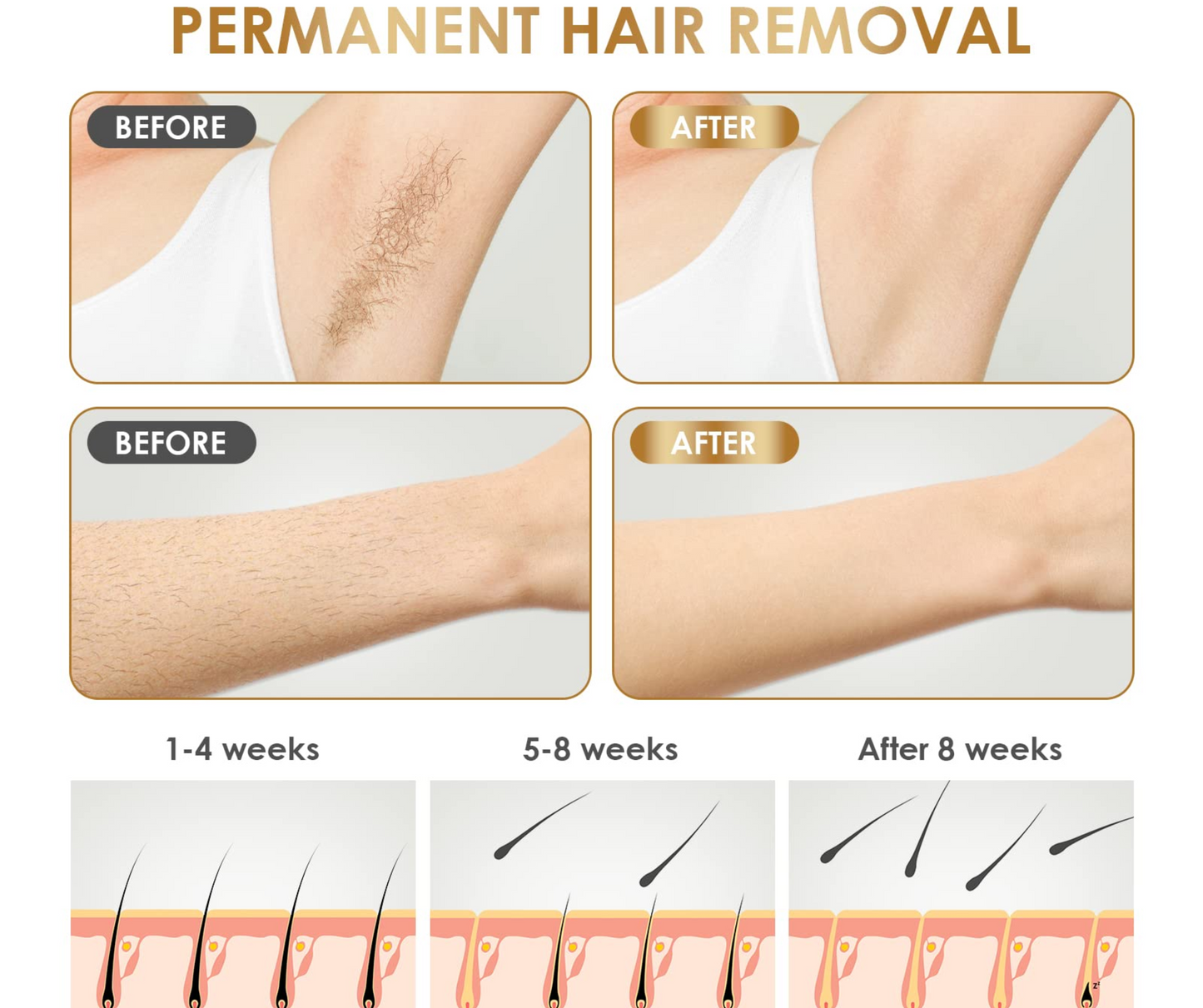 IPL SKINS® - #1 in Permanent Hair Removal