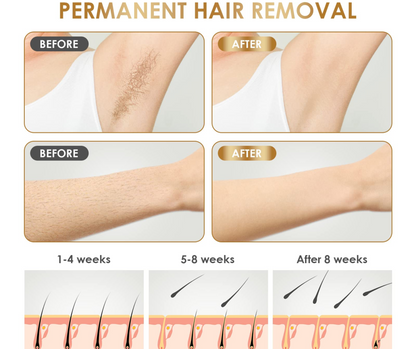 IPL SKINS® - #1 in Permanent Hair Removal